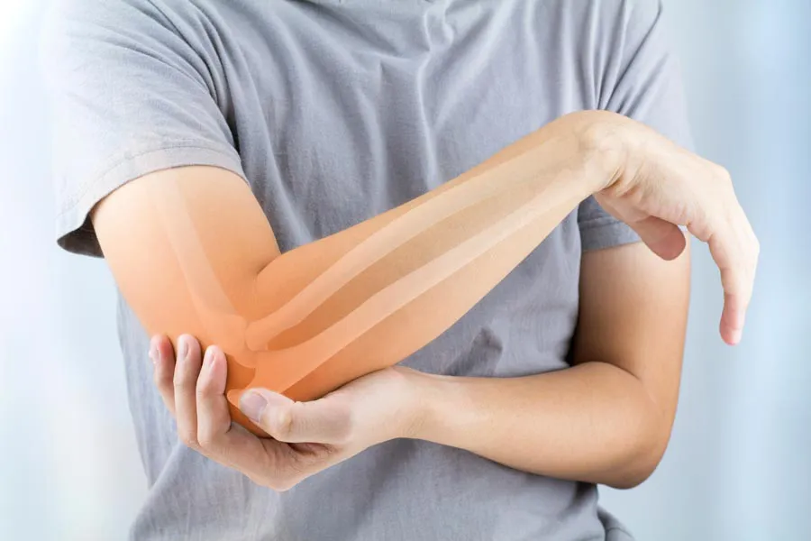 A close-up of a woman holding her elbow with an illustration of the bones and joint experiencing pain from osteoporosis. Get osteoporosis treatment from Shelley Cole, M.D. of Healthy Success in Temple, Texas.